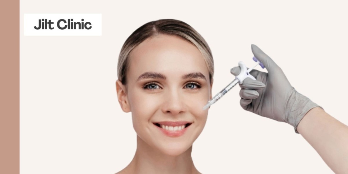 Marionettenfalten: Ursachen, Behandlung und ästhetische Lösungen