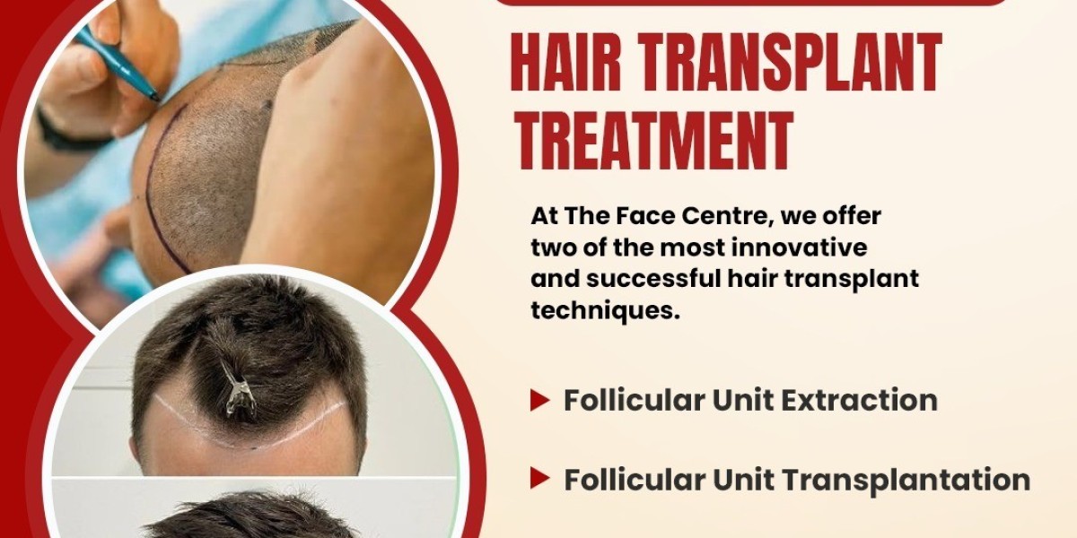 Best Hair Transplant in NCR: A Complete Guide to Permanent Hair Restoration